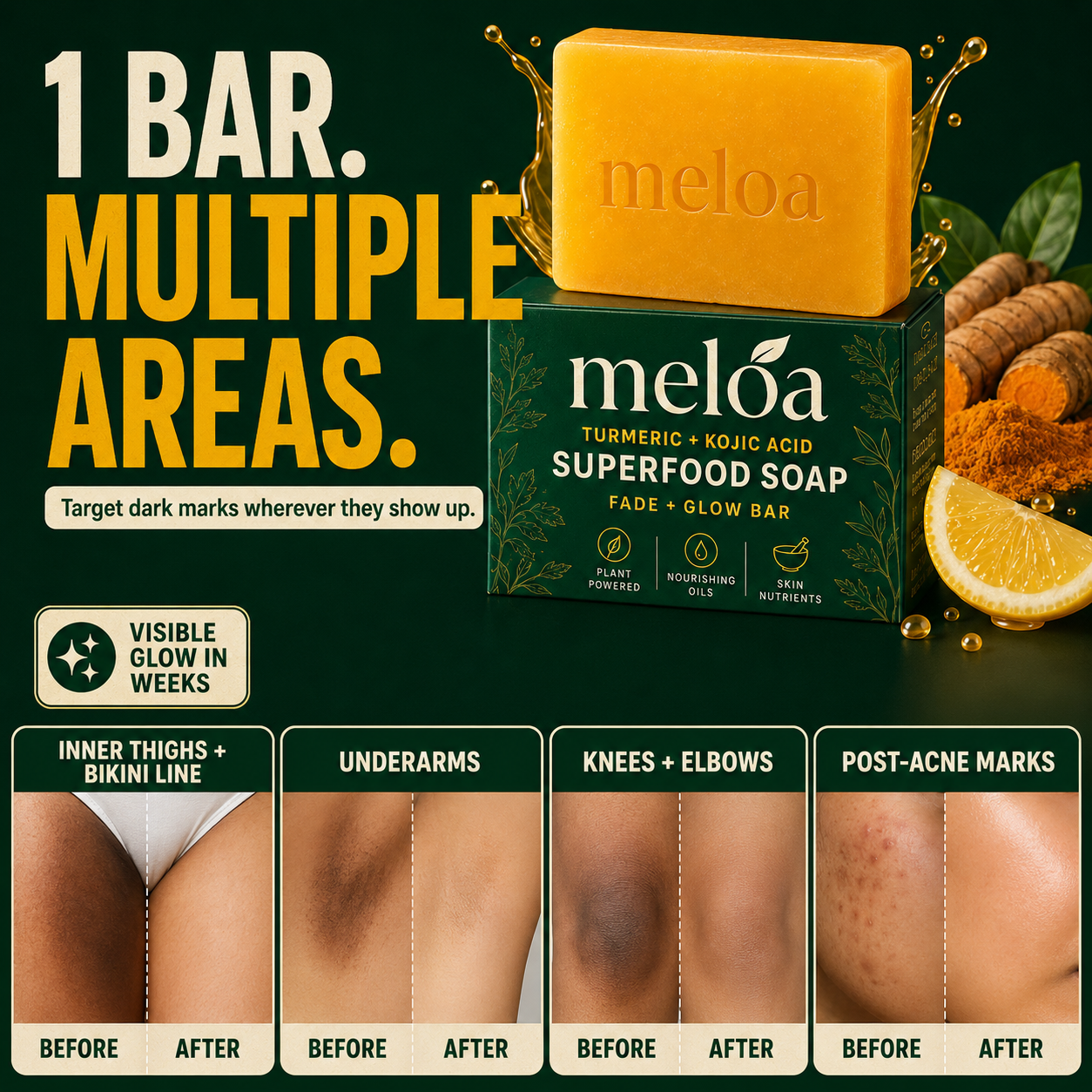 Meloa Turmeric + Kojic Fade & Glow Soap
