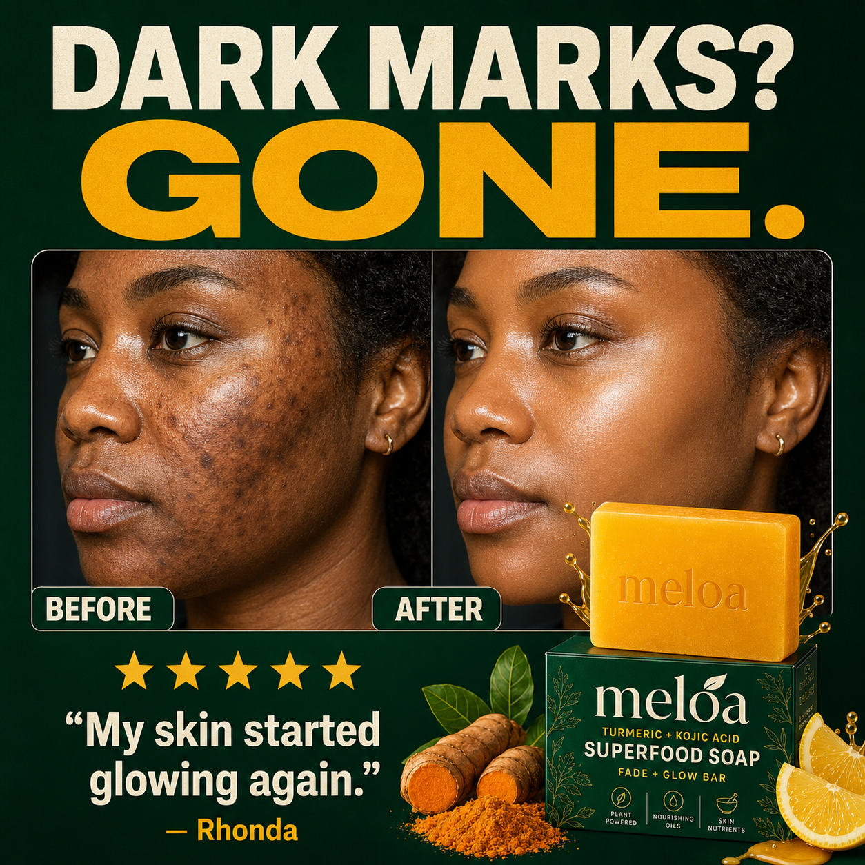 Meloa Turmeric + Kojic Fade & Glow Soap