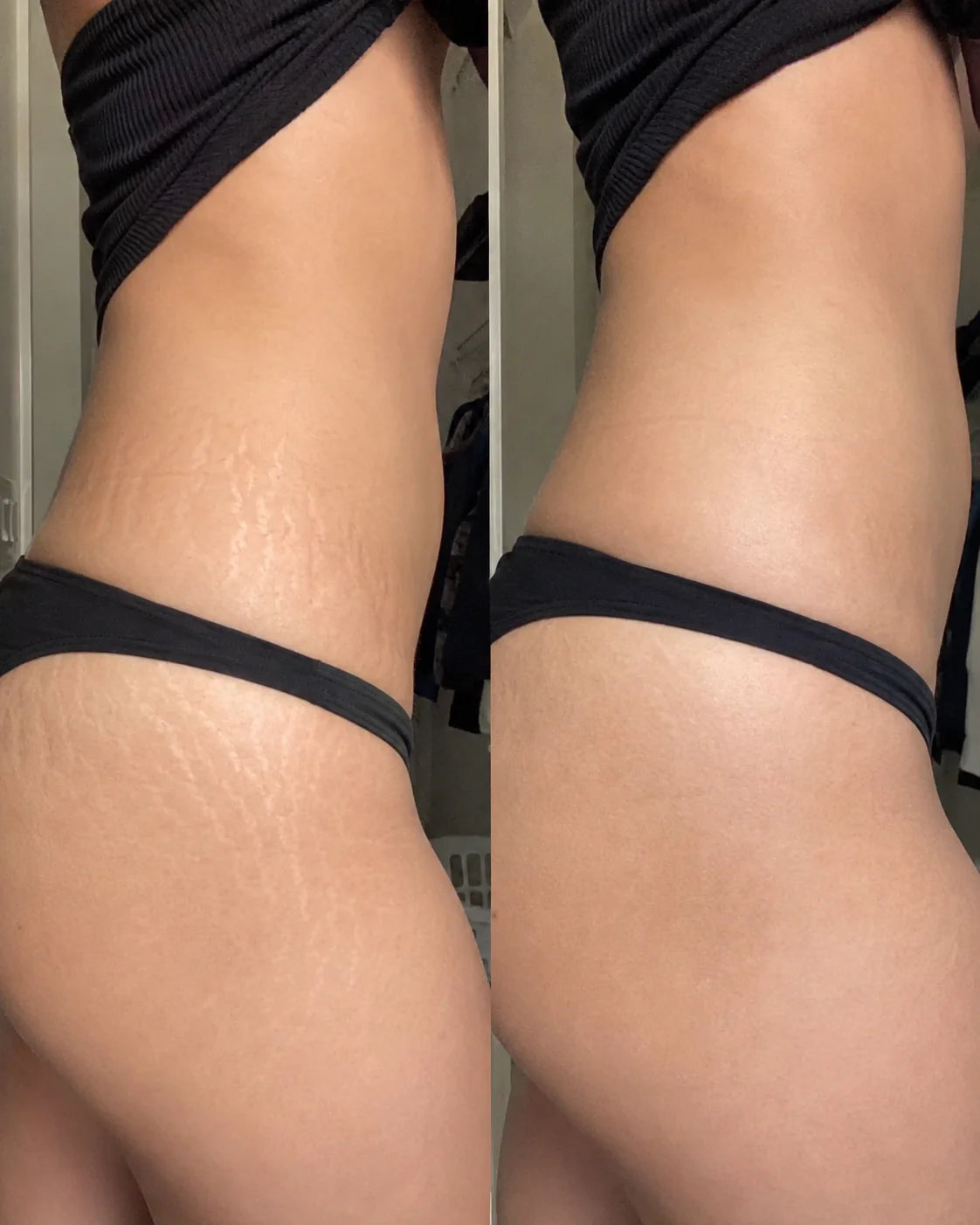 Body oil result