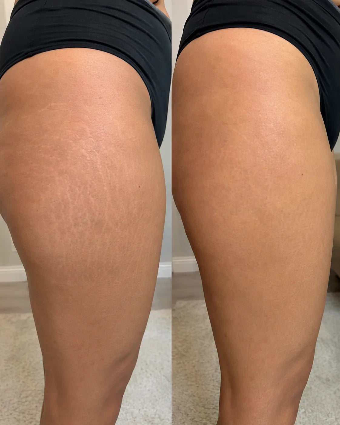 Body oil result